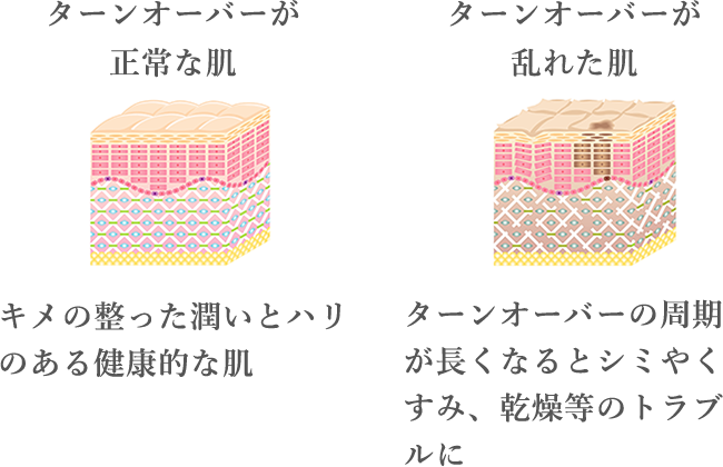 ターンオーバーが正常な肌 キメの整った潤いとハリのある健康的な肌 ターンオーバーが乱れた肌 ターンオーバーの周期が長くなるとシミやくすみ、乾燥等のトラブルに